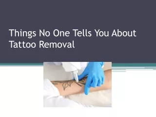 Things No One Tells You About Tattoo Removal