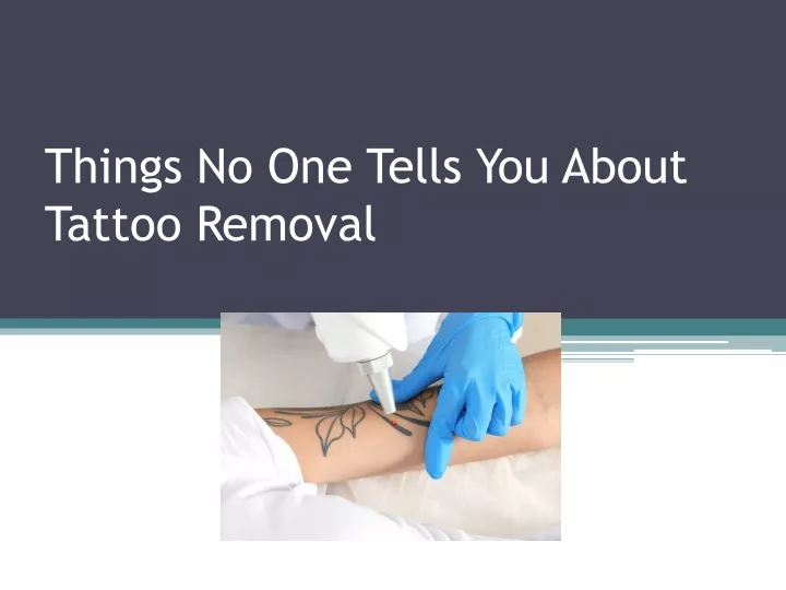 things no one tells you about tattoo removal