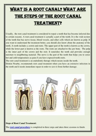 What is a root canal What are the steps of the root canal treatment