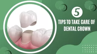5 Tips to Take Care of Dental Crown