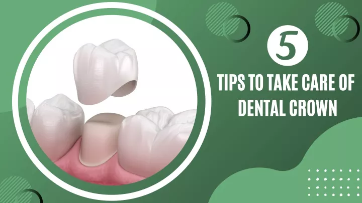 tips to take care of dental crown