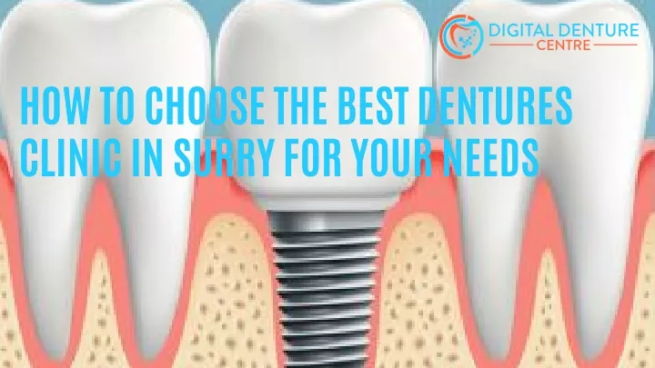 how to choose the best dentures clinic in surry
