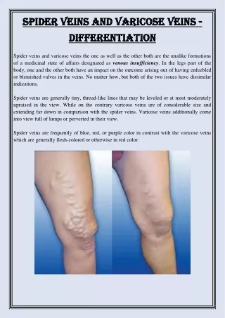 spider veins and varicose veins spider veins