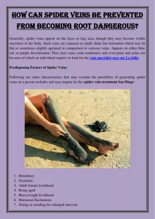 how can spider veins be prevented how can spider