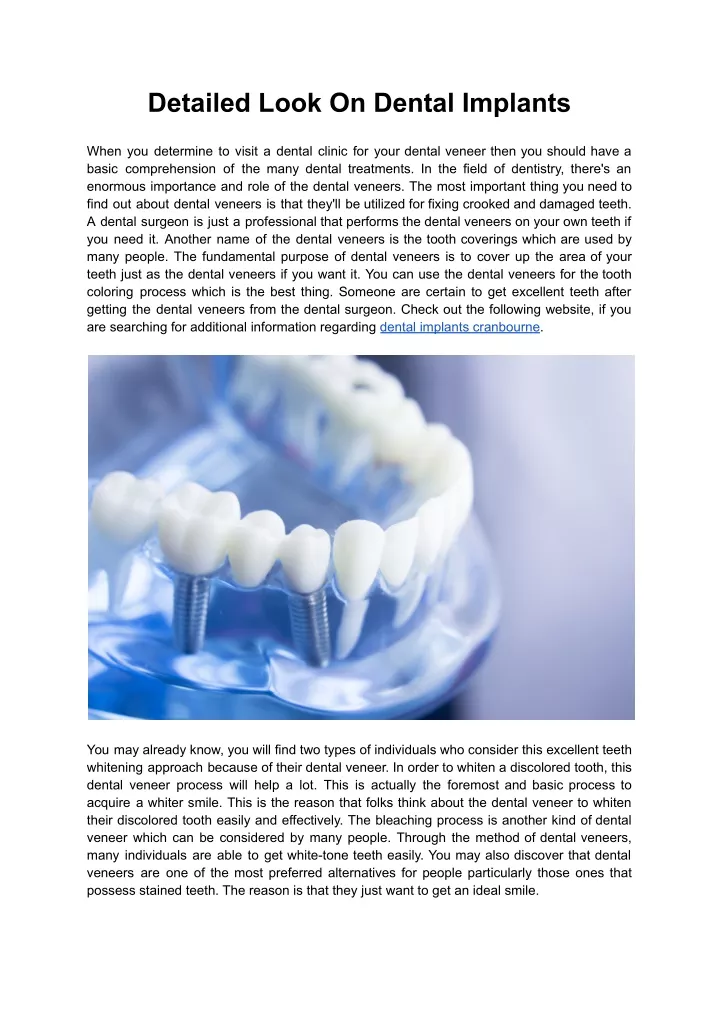 detailed look on dental implants