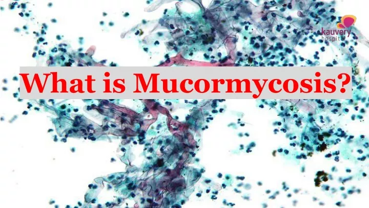 what is mucormycosis