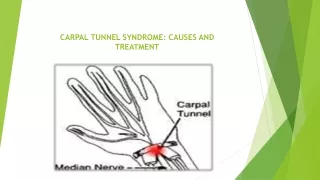 CARPAL TUNNEL SYNDROME CAUSES AND TREATMENT
