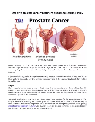 Effective prostate cancer treatment options to seek in Turkey