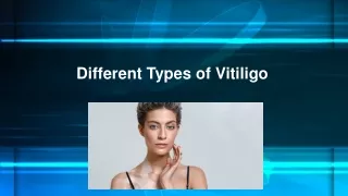 Different Types of Vitiligo
