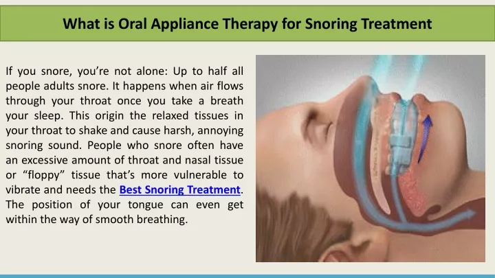 what is oral appliance therapy for snoring