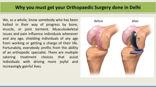 Why you must get your Orthopaedic Surgery done in Delhi