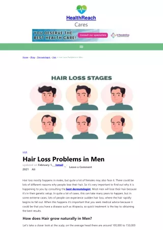 Hair Loss Problems in Men