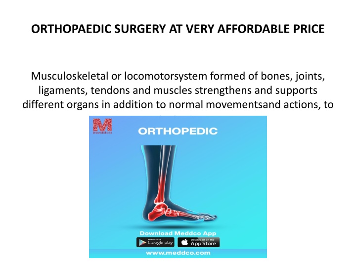 orthopaedic surgery at very affordable price