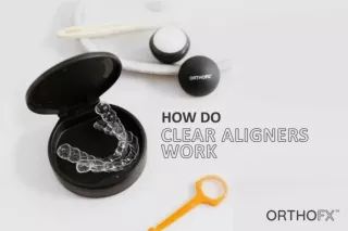 How Do Clear Aligners Work? | Clear Aligner Treatment | OrthoFX