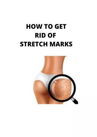 How to Get Rid Of Stretch Marks