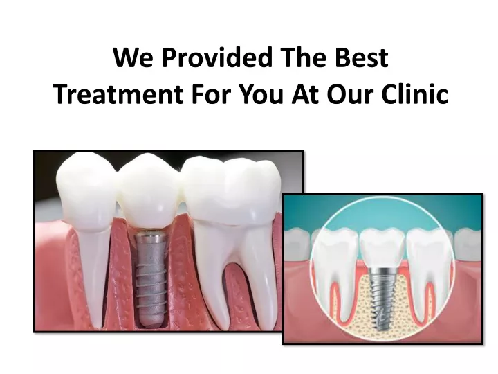 we provided the best treatment for you at our clinic