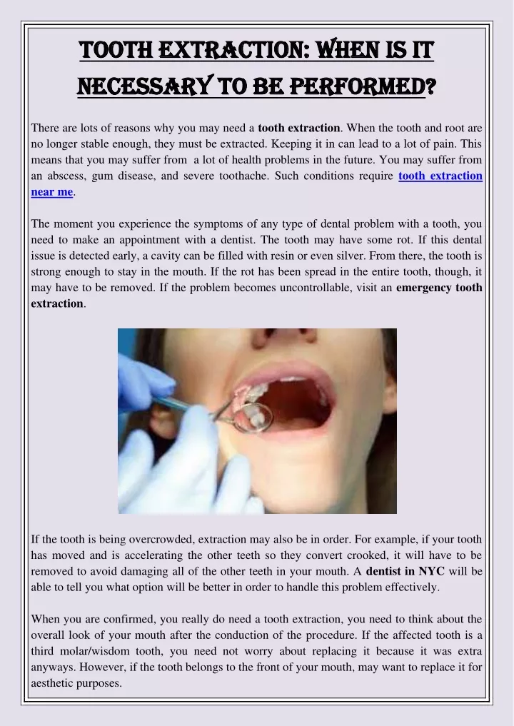 tooth extraction when is it tooth extraction when