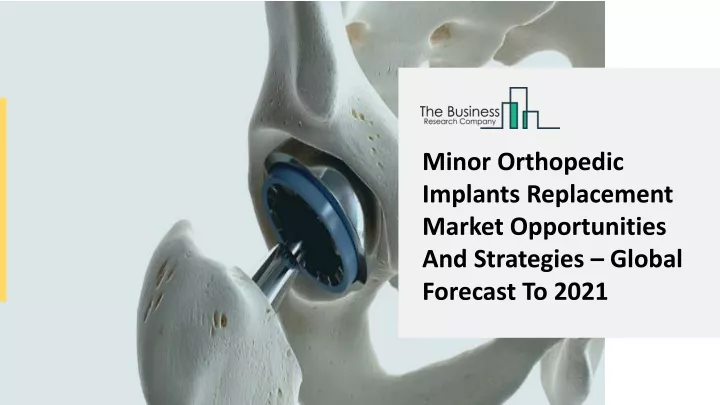minor orthopedic implants replacement market