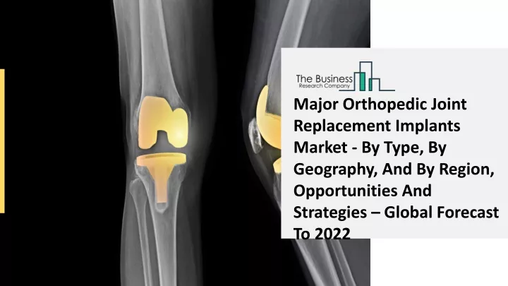 major orthopedic joint replacement implants