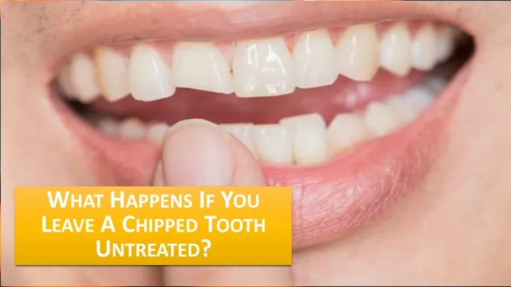 what happens if you leave a chipped tooth untreated