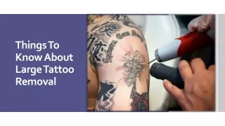 Things To Know About Large Tattoo Removal
