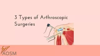 3 types of arthroscopic surgeries
