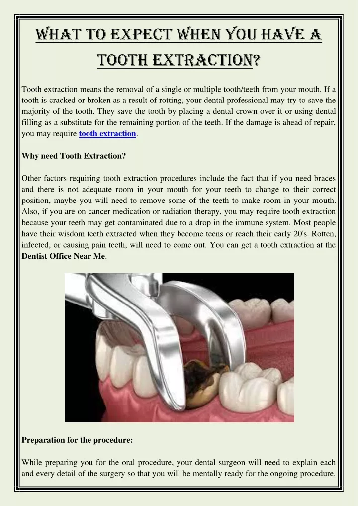 what to expect when you have a tooth extraction