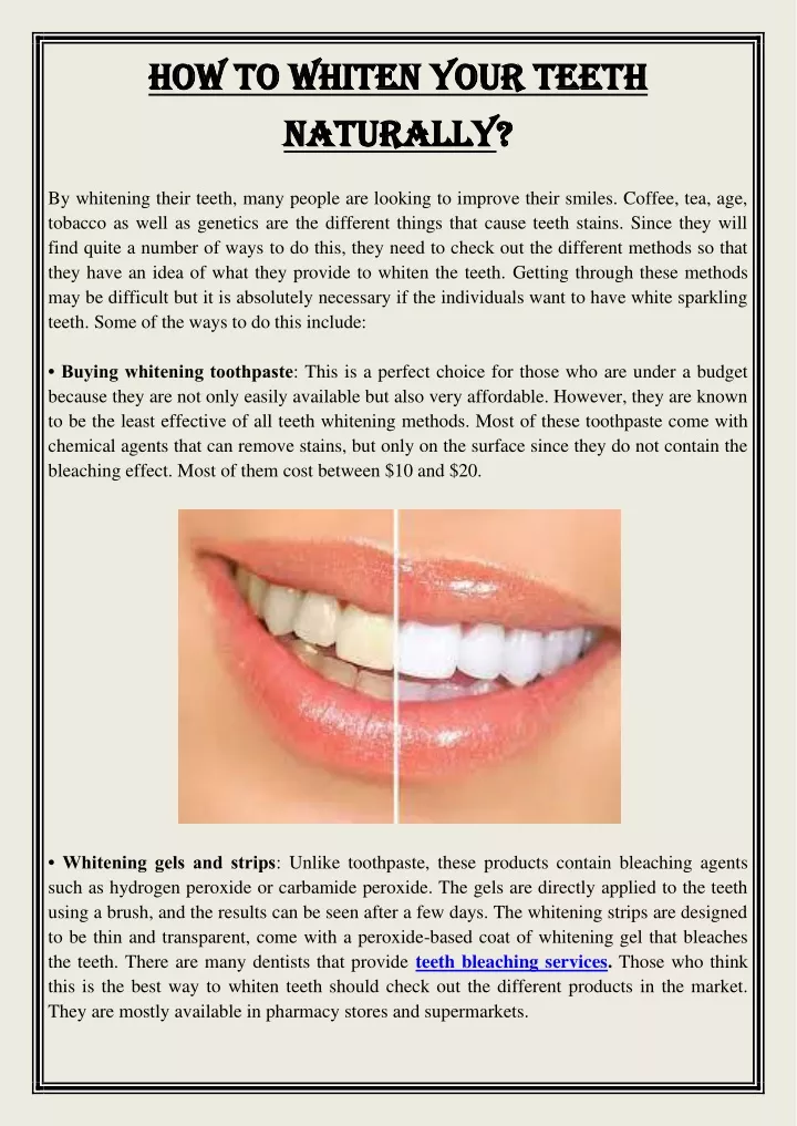 how to whiten your teeth how to whiten your teeth