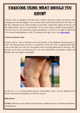 varicose veins what should you varicose veins