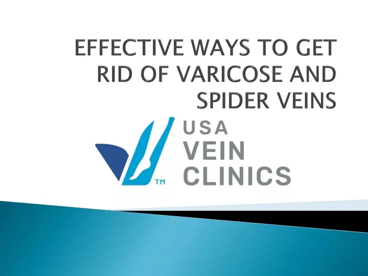 effective ways to get rid of varicose and spider veins