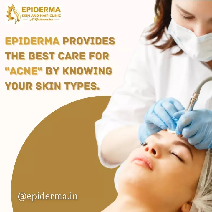 Ppt Acne Treatment Best Dermatology Centres In Jayanagar Bangalore Epiderma Clinic 1774