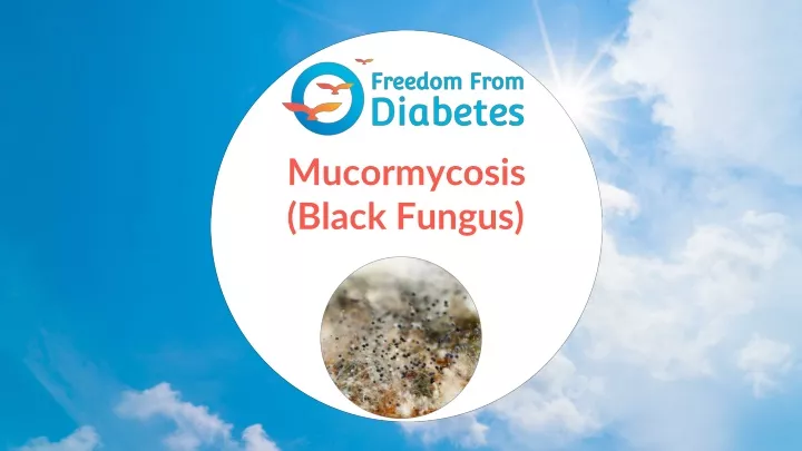 mucormycosis black fungus