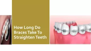 How Long Do Braces Take To Straighten Teeth