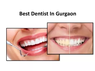 Best Dentist In Gurgaon