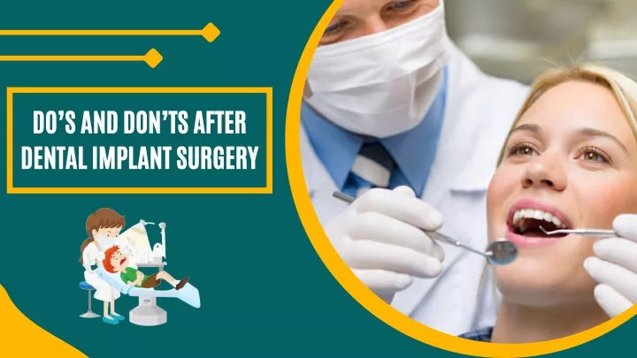 do s and don ts after dental implant surgery