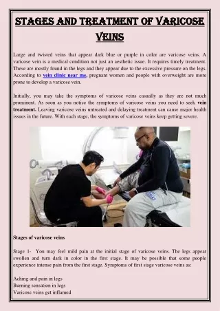 stages and treatment of varicose stages