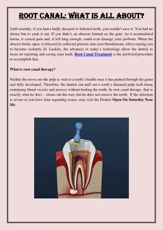 root canal what is all about root canal what