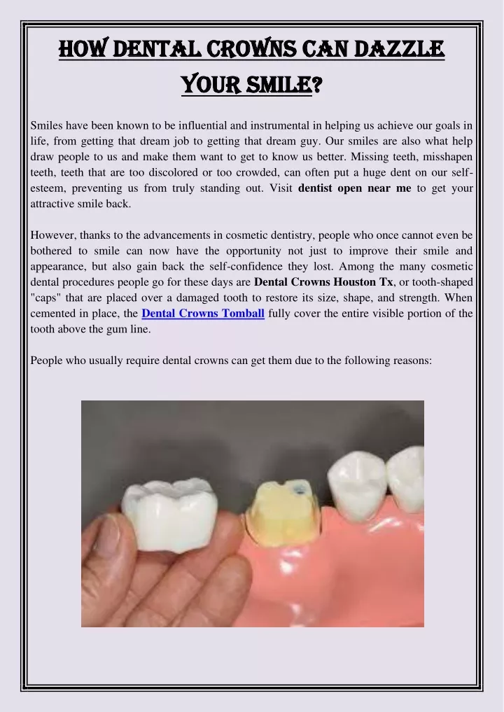 how dental crowns can dazzle how dental crowns