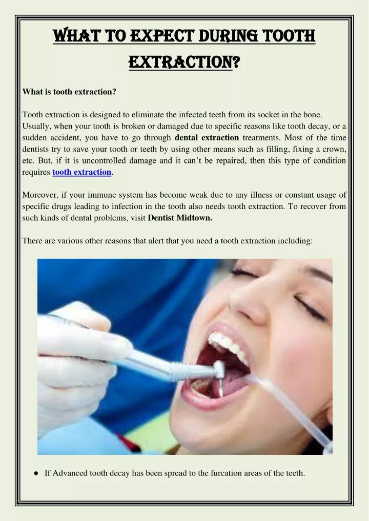 what to expect during tooth what to expect during