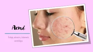 Tratamiento Cosmetológico del Acné