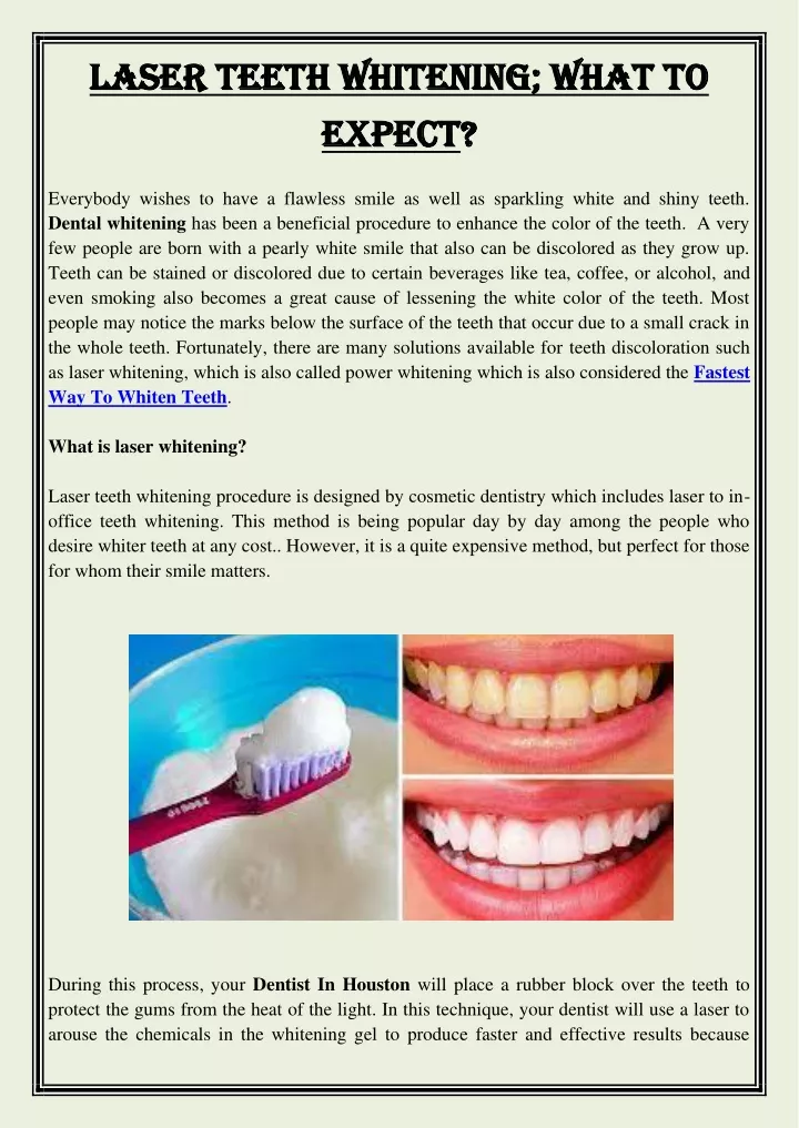 laser teeth whitening what to laser teeth