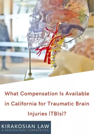 What Compensation Is Available in California for Traumatic Brain Injuries (TBIs)