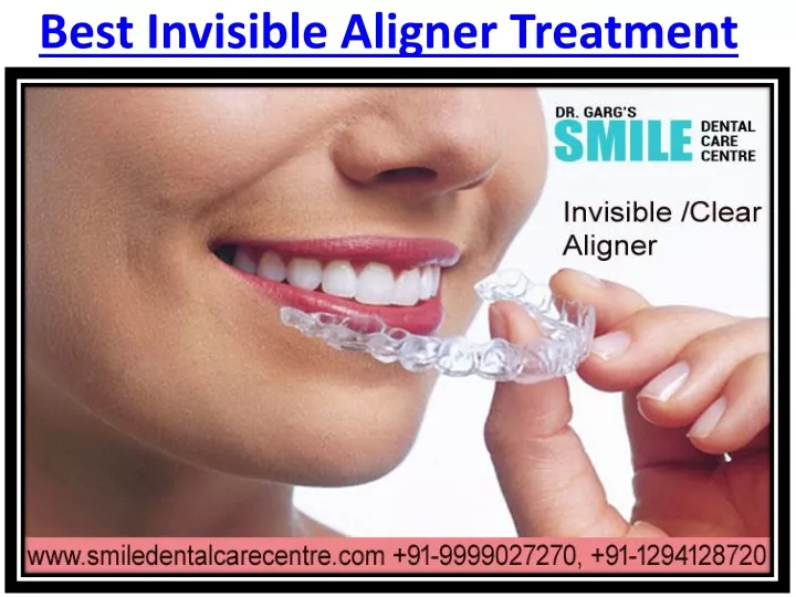 best invisible aligner treatment