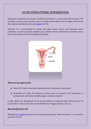 iui or intrauterine insemination intrauterine