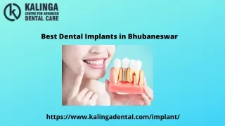 best dental implants in Bhubaneswar