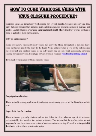 how to cure varicose veins with how to cure