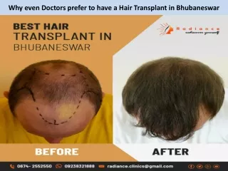 Why even Doctors prefer to have a Hair Transplant in Bhubaneswar