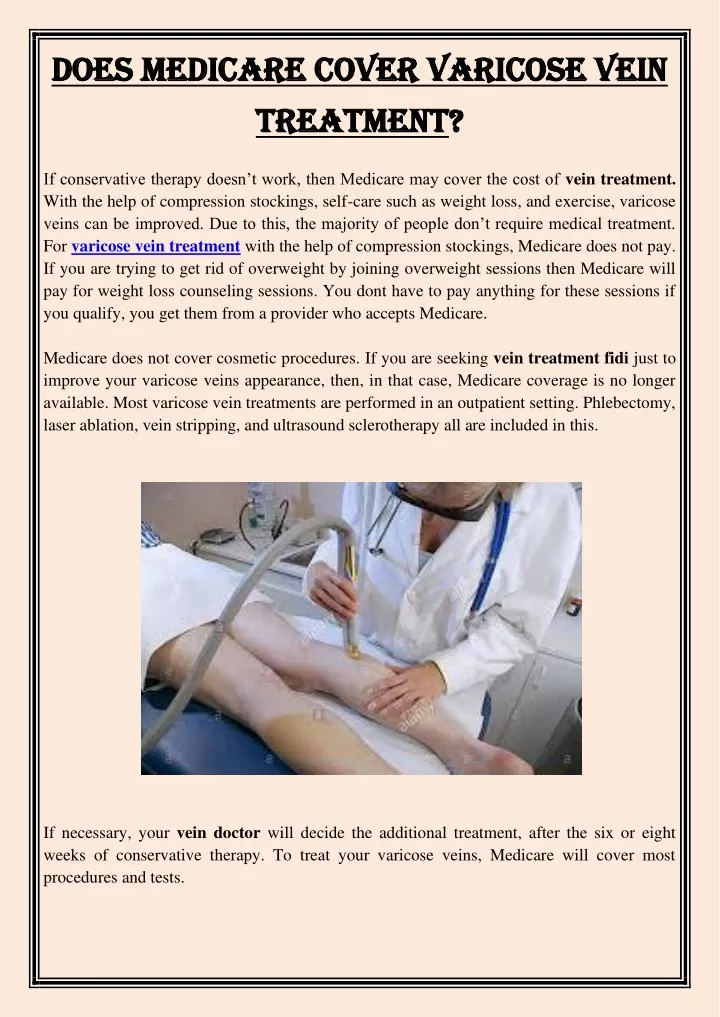 does medicare cover varicose vein does medicare
