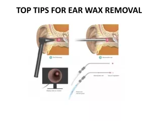 TOP TIPS FOR EAR WAX REMOVAL  | ear wax removal near me