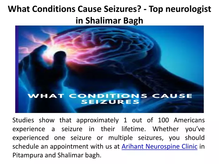 what conditions cause seizures top neurologist